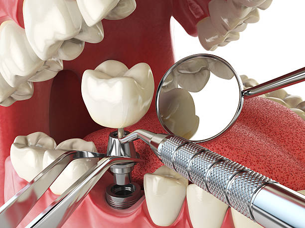 Best Emergency Treatment for Jaw Pain or Injury in Sharon, TN