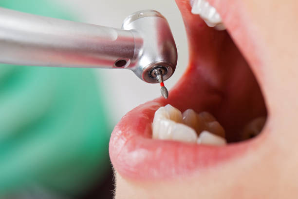 Best Emergency Denture Repair in Sharon, TN